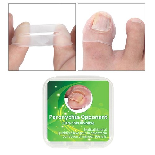New magideal toe nail ingrown - toe,